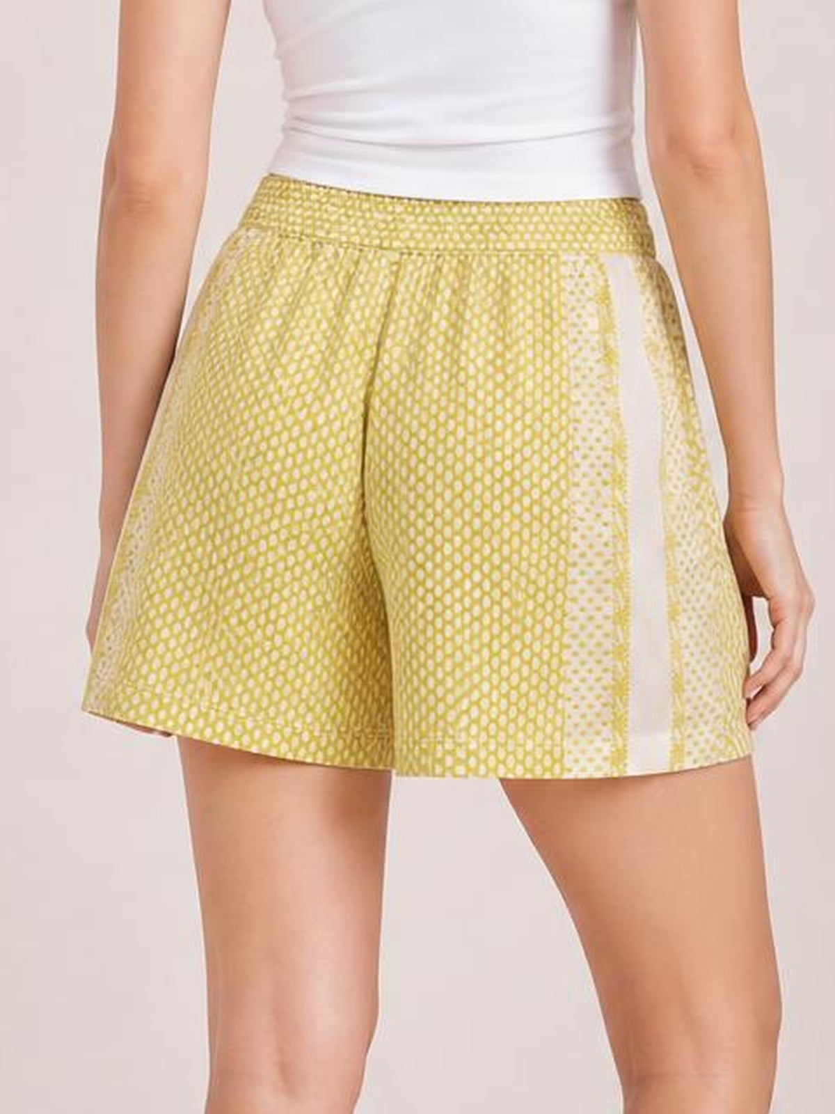 A model wears yellow-green patterned elastic waist shorts with a relaxed silhouette, wide hems, side pockets, and contrasting white side stripes.